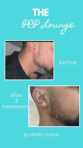 Beige and Gold Elegant Brows Lamination Before After Instagram Story (7)