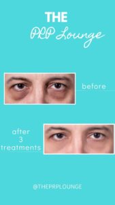 Beige and Gold Elegant Brows Lamination Before After Instagram Story (8)